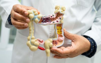 Gut Permeability – Causes, Consequences & Solutions