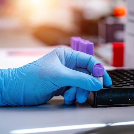 blood test blood test zurich